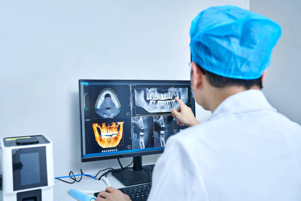 Best Chipped Tooth Repair Near Me  in Yorkville, NY
