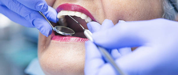 Best Urgent Tooth Repair  in Yorkville, NY