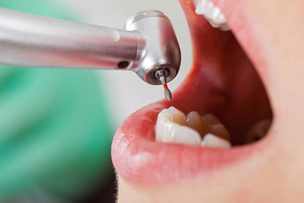 Best Knocked-Out Tooth Emergency  in Yorkville, NY